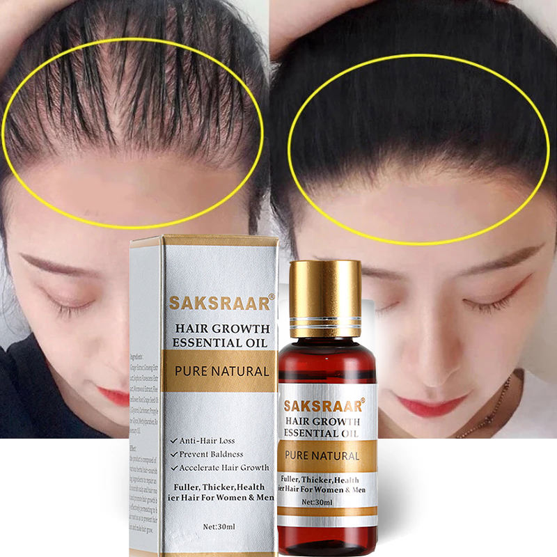 Hair Growth Spray – Anti Hair Loss Serum for Thicker, Stronger & Healthier Hair | Nourishing Scalp Treatment for Men & Women