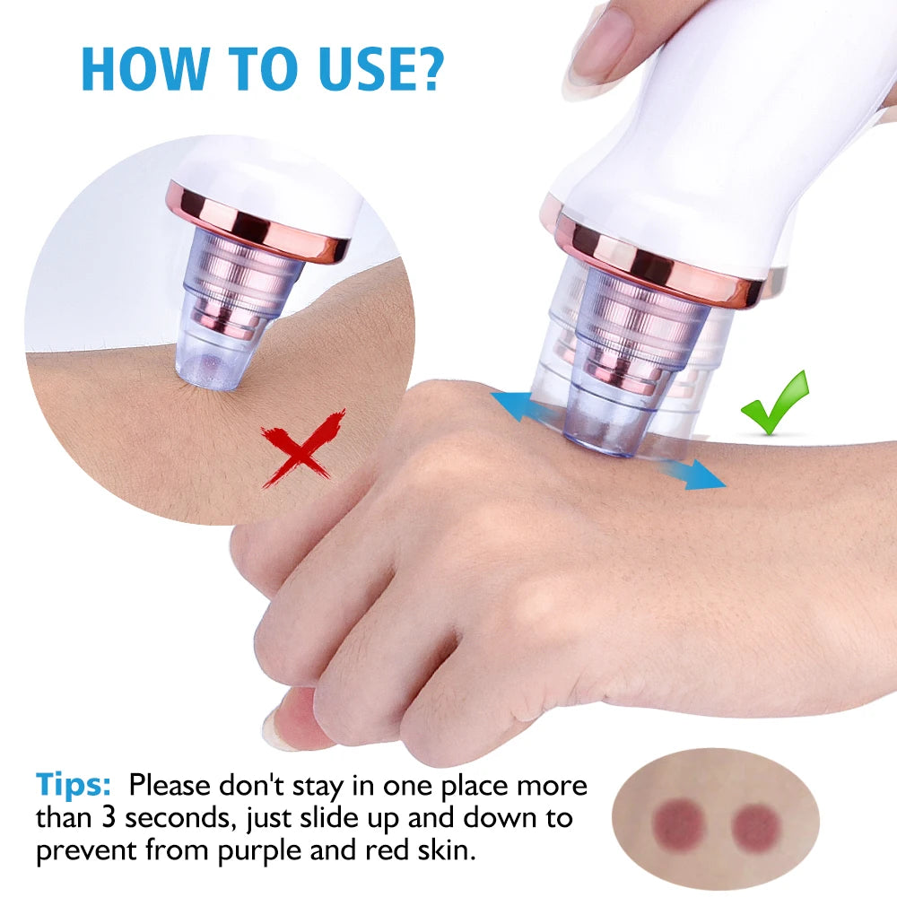 Pore Vacuum Cleaner Blackhead Remover