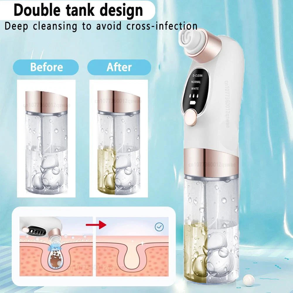 Electric Blackhead Remover Vacuum – Pore Cleaner & Facial Suction Device for Deep Cleansing, Whitehead Removal & Skin Rejuvenation
