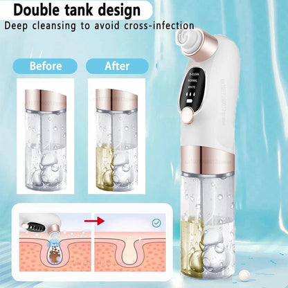 Electric Blackhead Remover Vacuum – Pore Cleaner & Facial Suction Device for Deep Cleansing, Whitehead Removal & Skin Rejuvenation