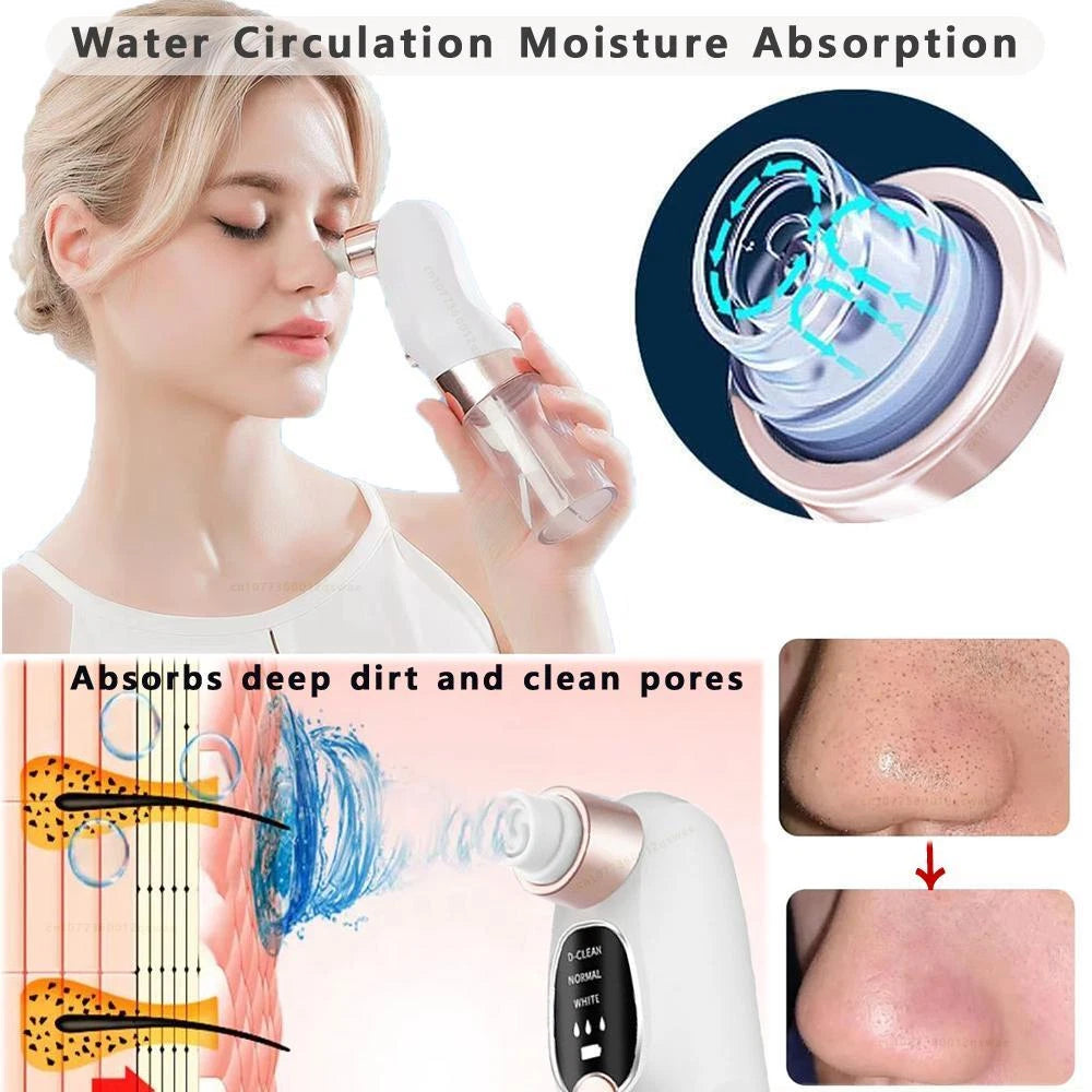 Electric Blackhead Remover Vacuum – Pore Cleaner & Facial Suction Device for Deep Cleansing, Whitehead Removal & Skin Rejuvenation