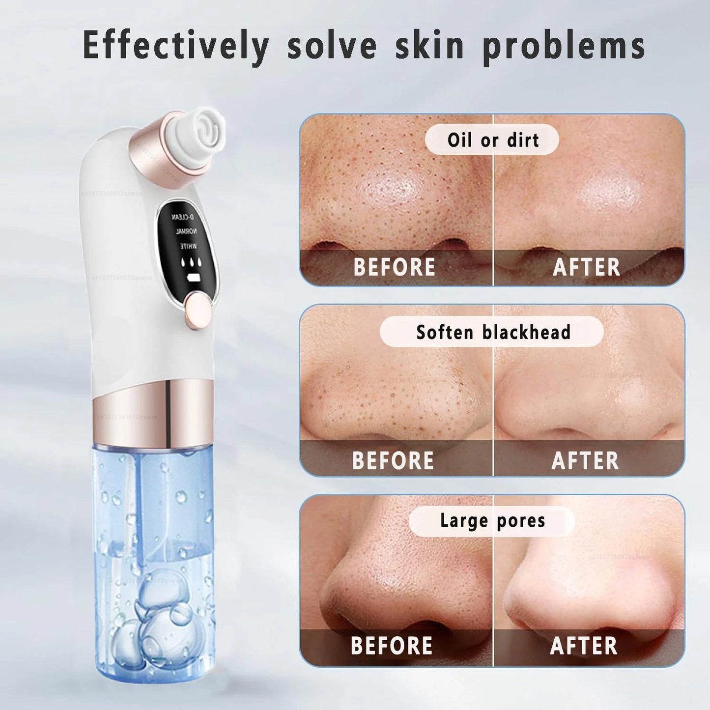 Electric Blackhead Remover Vacuum – Pore Cleaner & Facial Suction Device for Deep Cleansing, Whitehead Removal & Skin Rejuvenation