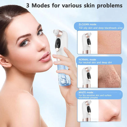 Electric Blackhead Remover Vacuum – Pore Cleaner & Facial Suction Device for Deep Cleansing, Whitehead Removal & Skin Rejuvenation