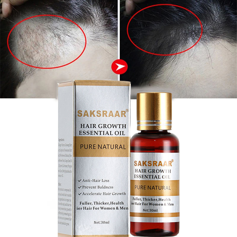 Hair Growth Spray – Anti Hair Loss Serum for Thicker, Stronger & Healthier Hair | Nourishing Scalp Treatment for Men & Women