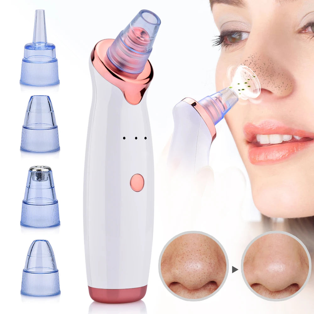 Pore Vacuum Cleaner Blackhead Remover