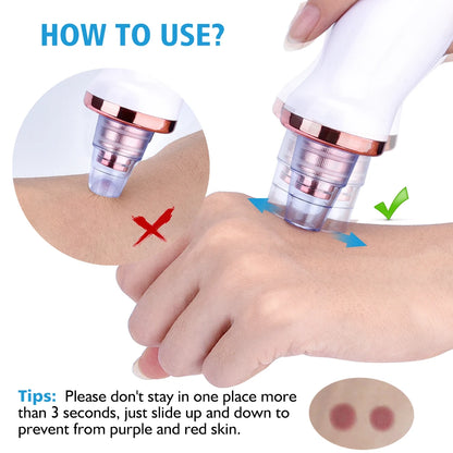 Pore Vacuum Cleaner Blackhead Remover