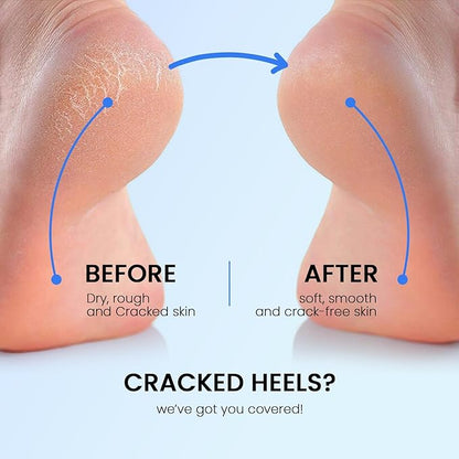 Rechargeable Electric Foot File for Dead Skin, Callus Removal & Smooth Heel Care