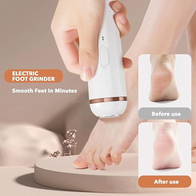 Rechargeable Electric Foot File for Dead Skin, Callus Removal & Smooth Heel Care